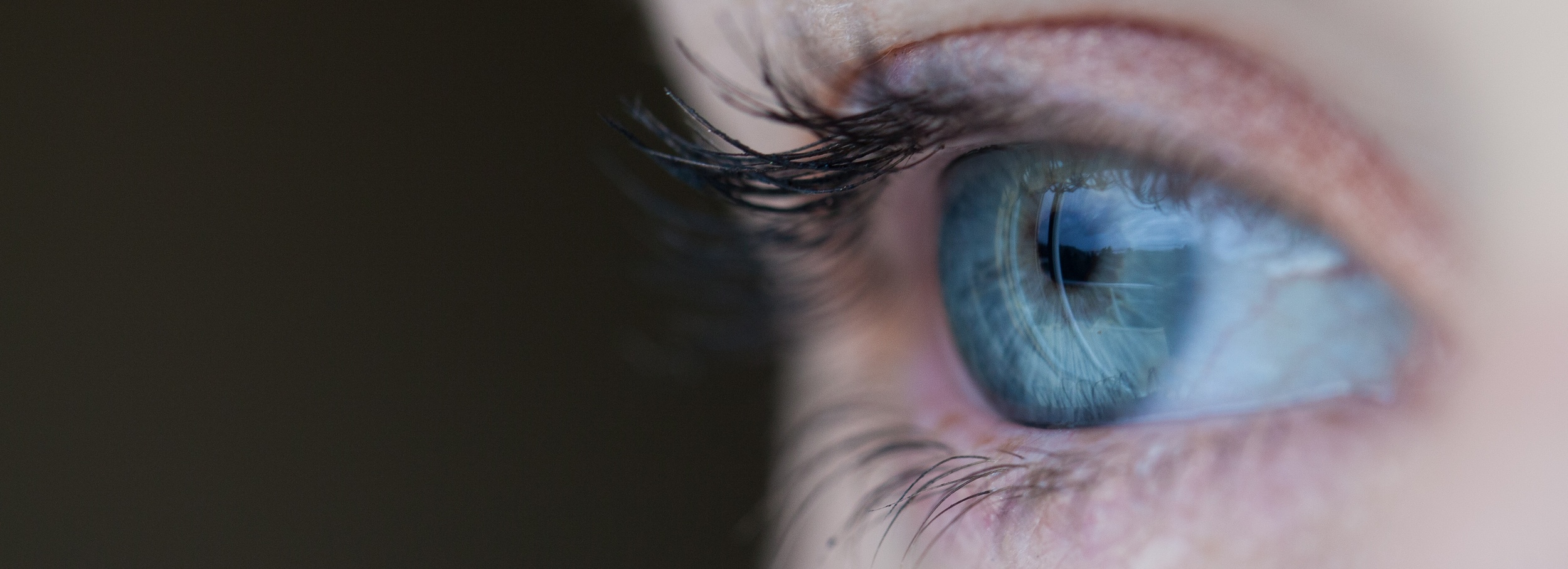 EMDR